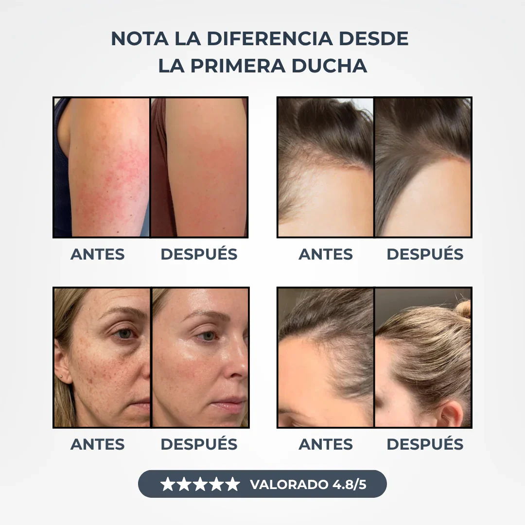 Cabezal De Ducha Con Filtro Antical y Anticloro Para Cuidar Tu Piel y Tu Cabello.
